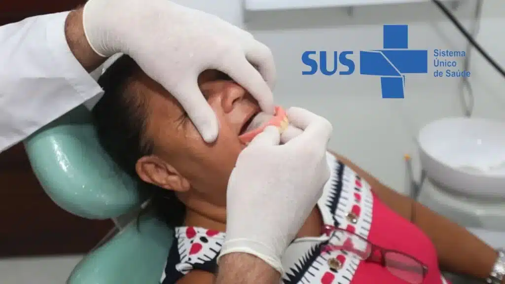 Tempo de Espera para Implantes Dentários pelo SUS: O Que Você Precisa Saber
